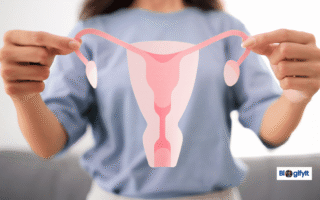 How to Get Pregnant Naturally with PCOS